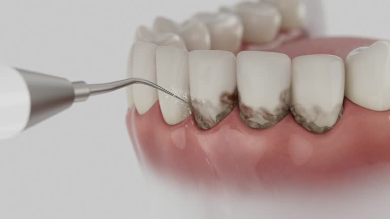 Reliable Root Canal Treatment contractor in Richland County County, ND by Dentist Open Now